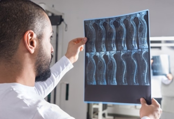 Man Holding an Image of Xray