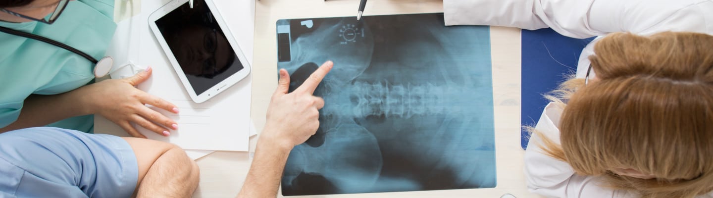 Doctor reviewing X-ray image